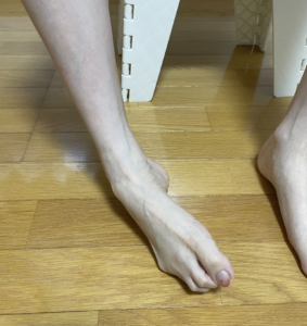 どうして内反足になるのか 脳とカラダの研究所 どうして内反足になるのか 脳とカラダの研究所